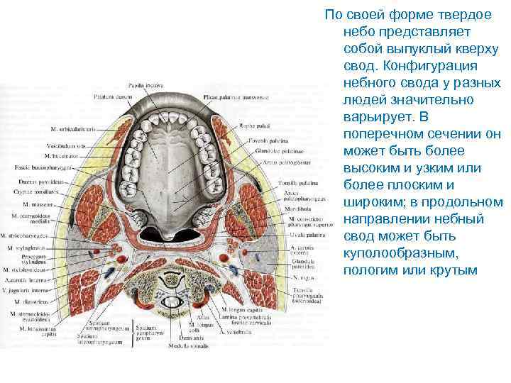 Рак небного язычка фото