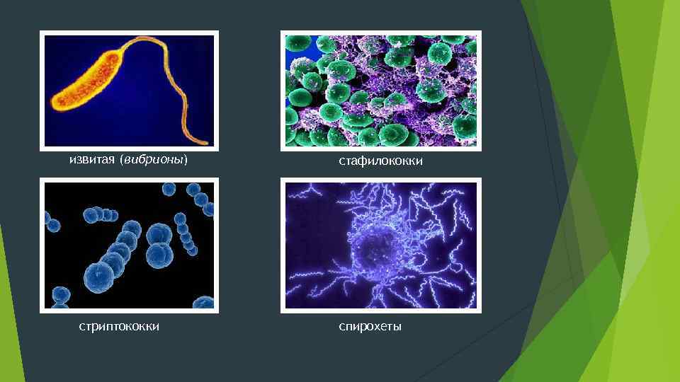 извитая (вибрионы) стриптококки стафилококки спирохеты 