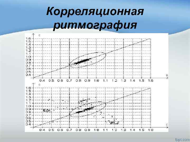 Корреляционная ритмография 