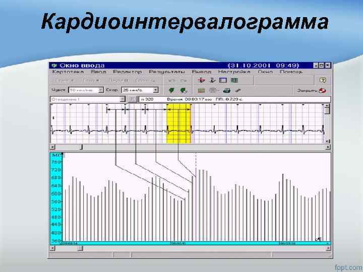  Кардиоинтервалограмма 