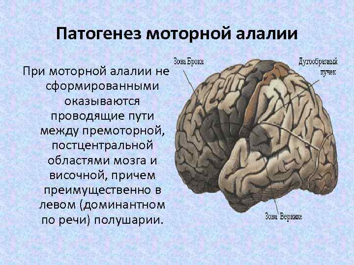 Патогенез моторной алалии При моторной алалии не сформированными оказываются проводящие пути между премоторной, постцентральной