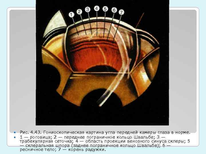  Рис. 4. 43. Гониоскопическая картина угла передней камеры глаза в норме. 1 —