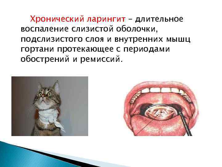 Хронический ларингит – длительное воспаление слизистой оболочки, подслизистого слоя и внутренних мышц гортани протекающее