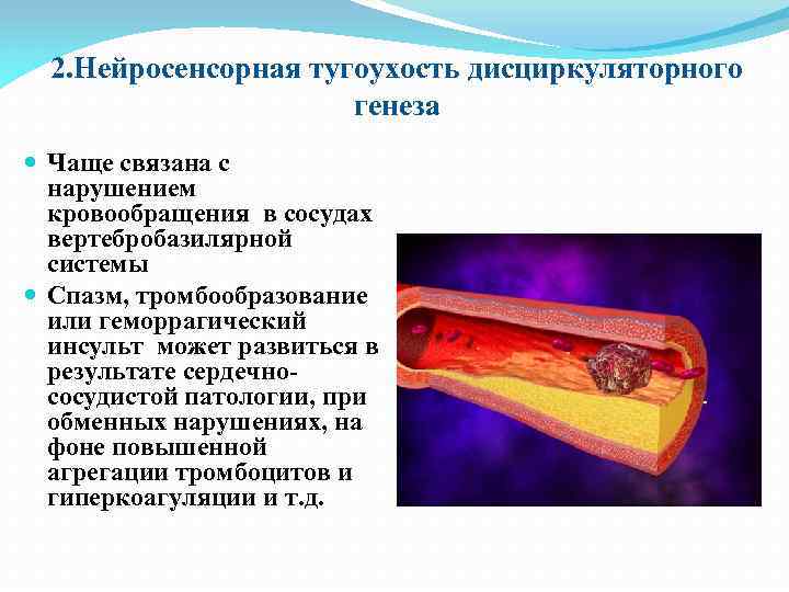 2. Нейросенсорная тугоухость дисциркуляторного генеза Чаще связана с нарушением кровообращения в сосудах вертебробазилярной системы
