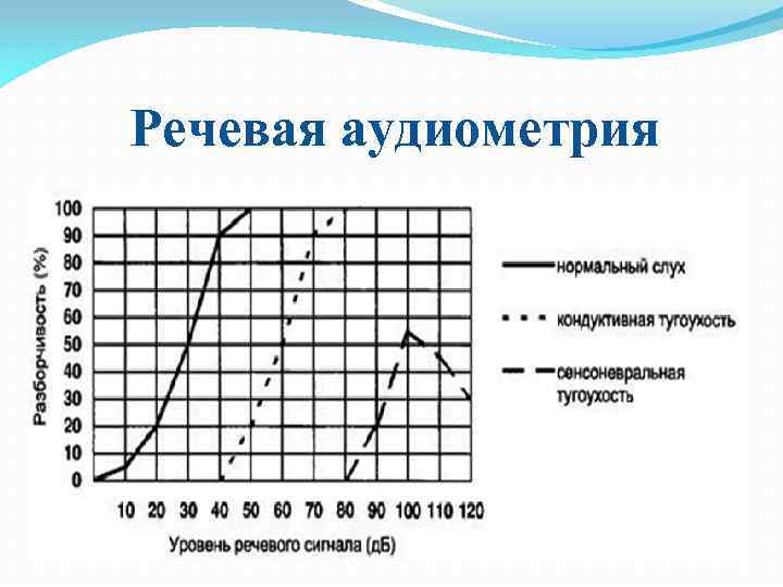 Речевая аудиометрия 