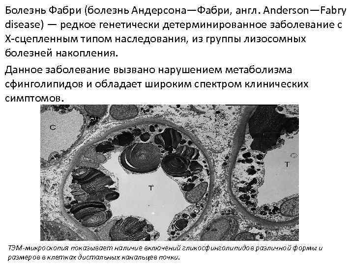 Болезнь Фабри (болезнь Андерсона—Фабри, англ. Anderson—Fabry disease) — редкое генетически детерминированное заболевание с Х-сцепленным
