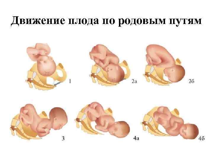 Движение плода по родовым путям 