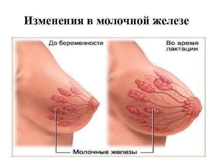 Изменения в молочной железе 