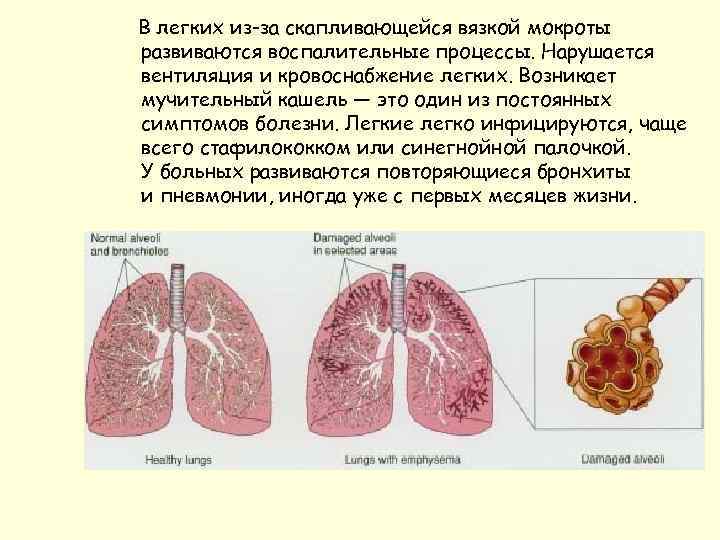 В легких из-за скапливающейся вязкой мокроты развиваются воспалительные процессы. Нарушается вентиляция и кровоснабжение легких.