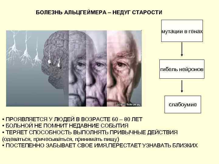 БОЛЕЗНЬ АЛЬЦГЕЙМЕРА – НЕДУГ СТАРОСТИ мутации в генах гибель нейронов слабоумие • ПРОЯВЛЯЕТСЯ У