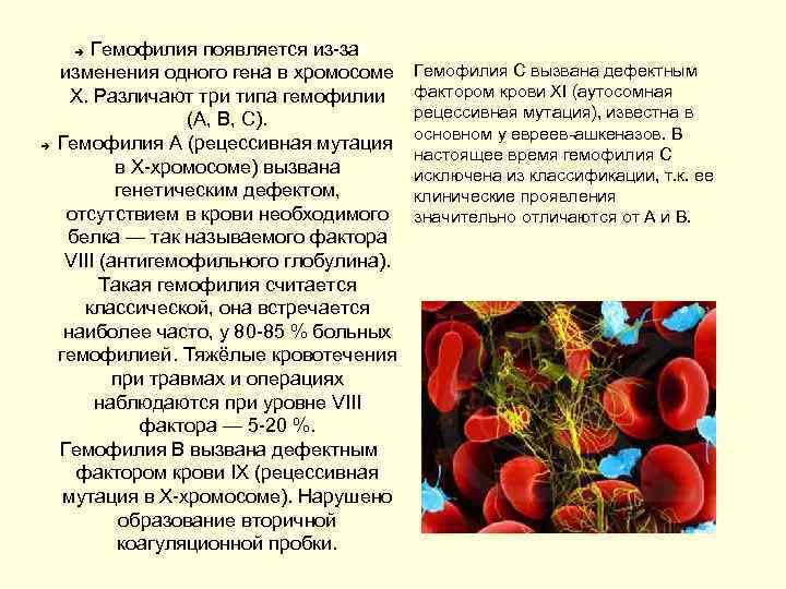 Гемофилия появляется из-за изменения одного гена в хромосоме X. Различают три типа гемофилии (A,