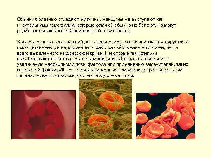 Обычно болезнью страдают мужчины, женщины же выступают как носительницы гемофилии, которые сами ей обычно