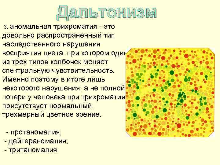 Дальтонизм 3. аномальная трихроматия - это довольно распространенный тип наследственного нарушения восприятия цвета, при