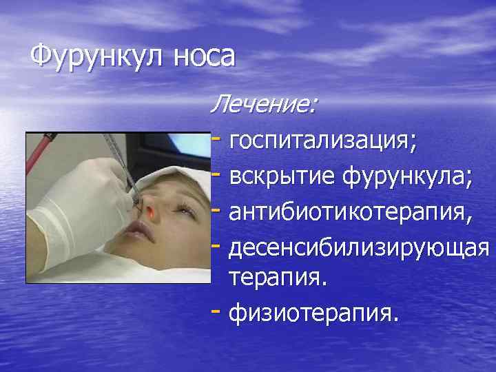 Фурункул носа Лечение: - госпитализация; - вскрытие фурункула; - антибиотикотерапия, - десенсибилизирующая терапия. -