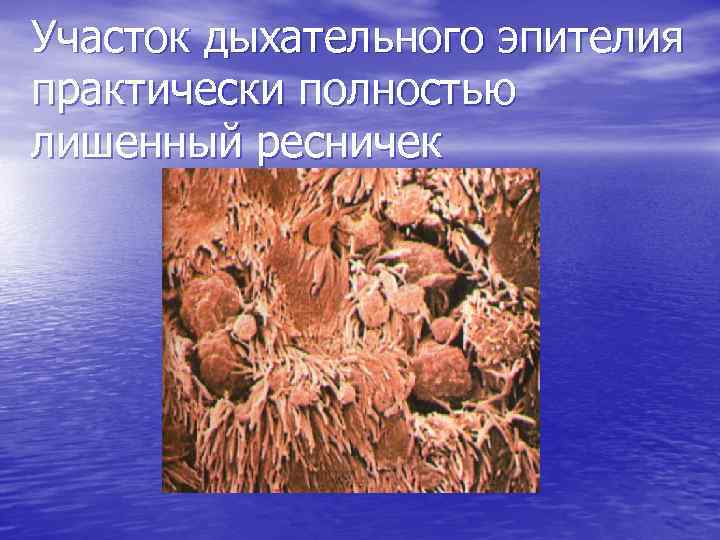 Участок дыхательного эпителия практически полностью лишенный ресничек 