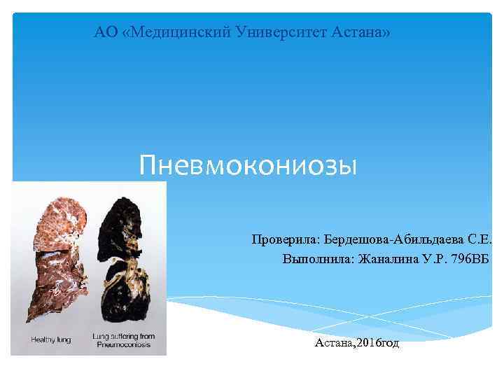 АО «Медицинский Университет Астана» Пневмокониозы Проверила: Бердешова-Абильдаева С. Е. Выполнила: Жаналина У. Р. 796