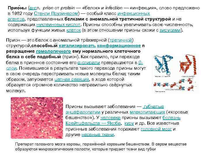 Прио ны (англ. prion от protein — «белок» и infection — «инфекция» , слово