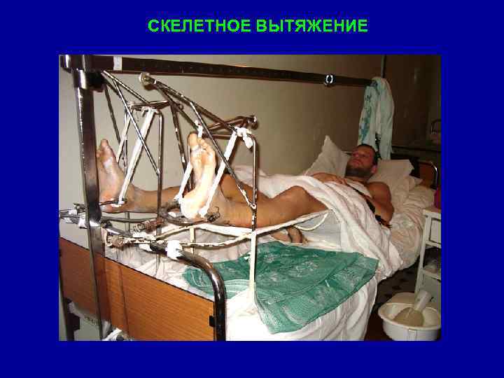 СКЕЛЕТНОЕ ВЫТЯЖЕНИЕ 