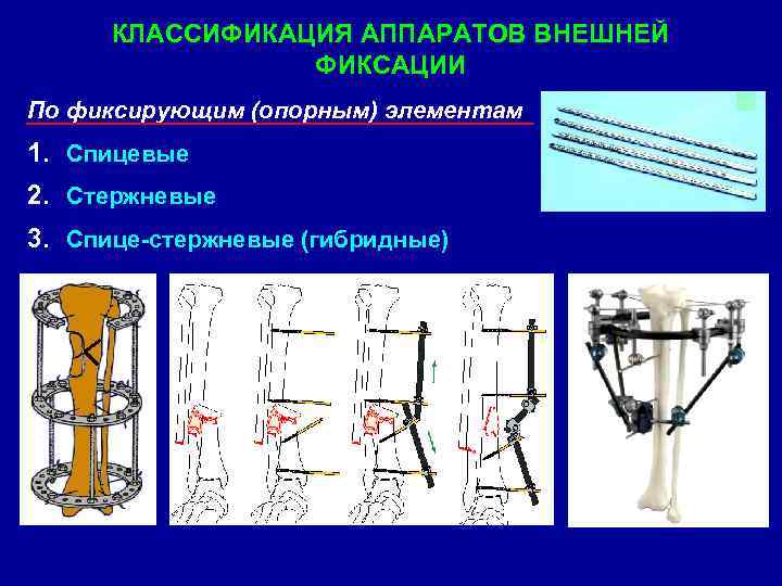 Классификация аппаратов