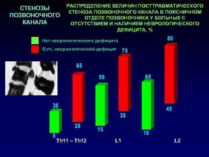 РАСПРЕДЕЛЕНИЕ ВЕЛИЧИН ПОСТТРАВМАТИЧЕСКОГО СТЕНОЗЫ СТЕНОЗА ПОЗВОНОЧНОГО КАНАЛА В ПОЯСНИЧНОМ ПОЗВОНОЧНОГО ОТДЕЛЕ ПОЗВОНОЧНИКА У БОЛЬНЫХ