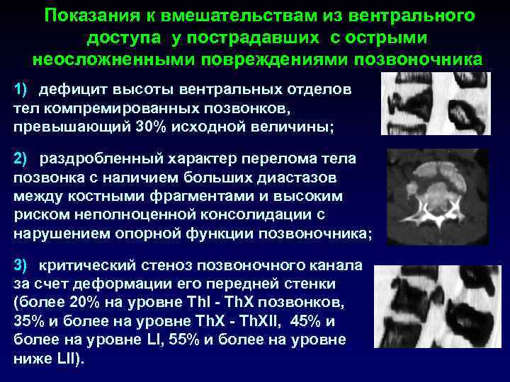  Показания к вмешательствам из вентрального доступа у пострадавших с острыми неосложненными повреждениями позвоночника