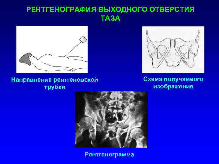 При рентгеноскопии изображение получается