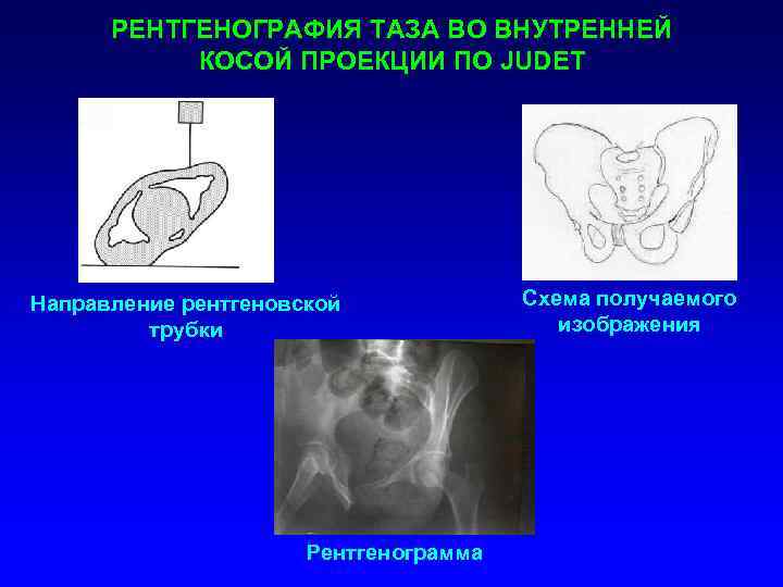 Проекции рентгенограмм. Рентген таза в прямой проекции. Косая проекция рентген. Рентгенография в косых проекциях.