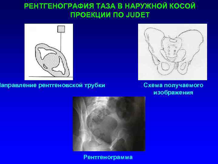 Проекции рентгена