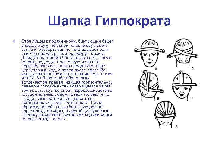 Шапка Гиппократа • Стоя лицом к пораженному, бинтующий берет в каждую руку по одной