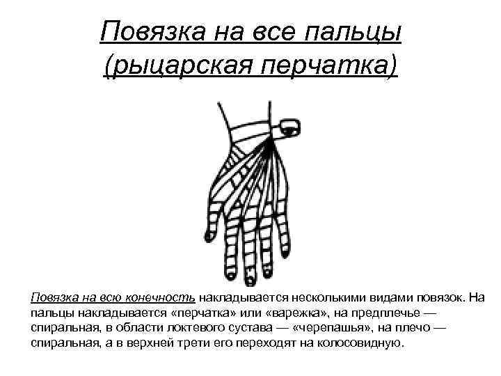 Повязка на все пальцы (рыцарская перчатка) Повязка на всю конечность накладывается несколькими видами повязок.