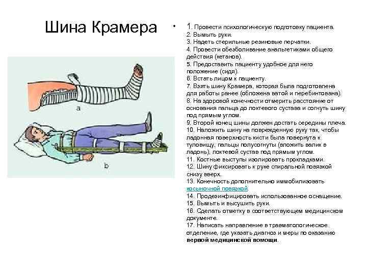 Шина Крамера • 1. Провести психологическую подготовку пациента. 2. Вымыть руки. 3. Надеть стерильные