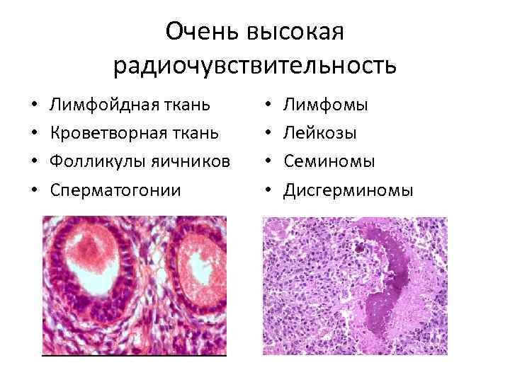 Очень высокая радиочувствительность • • Лимфойдная ткань Кроветворная ткань Фолликулы яичников Сперматогонии • •