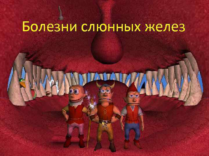 Болезни слюнных желез 