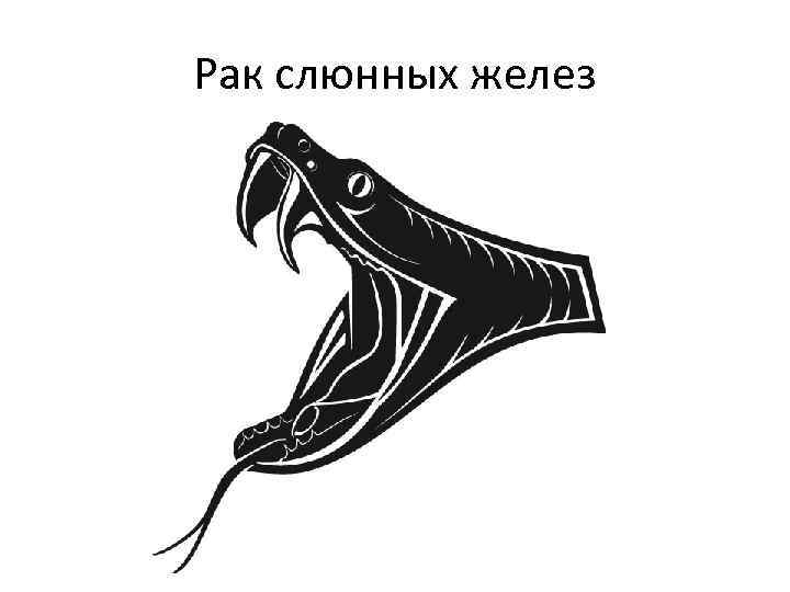 Рак слюнных желез 