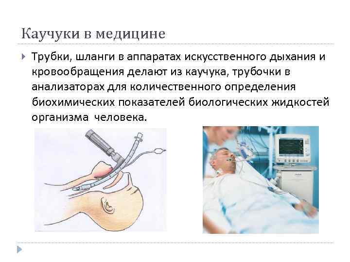 Каучуки в медицине Трубки, шланги в аппаратах искусственного дыхания и кровообращения делают из каучука,