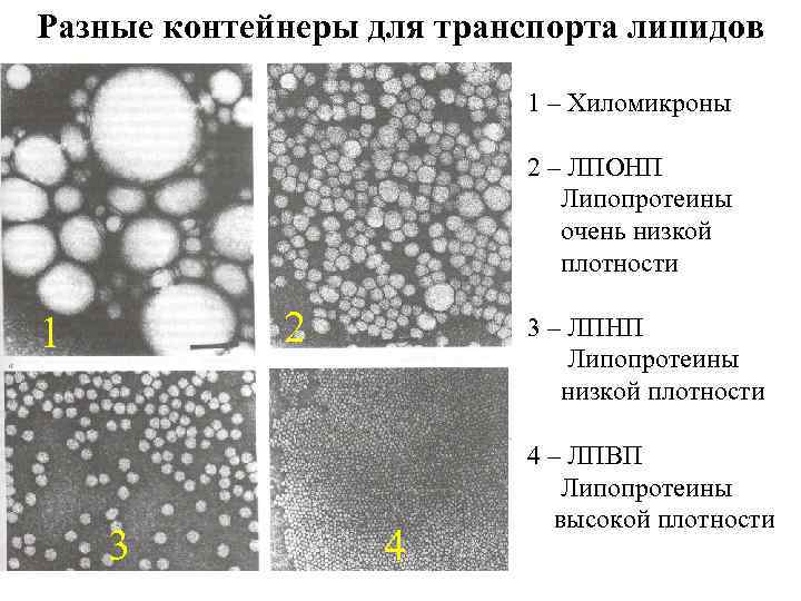 Разные контейнеры для транспорта липидов 1 – Хиломикроны 2 – ЛПОНП Липопротеины очень низкой