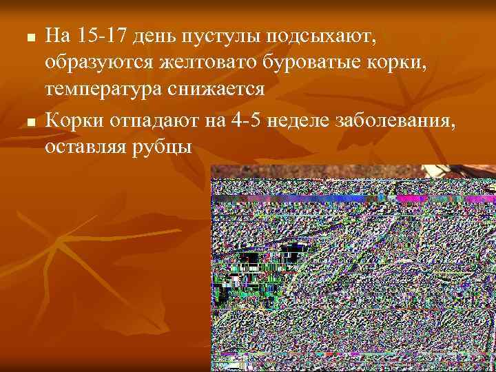 n n На 15 -17 день пустулы подсыхают, образуются желтовато буроватые корки, температура снижается