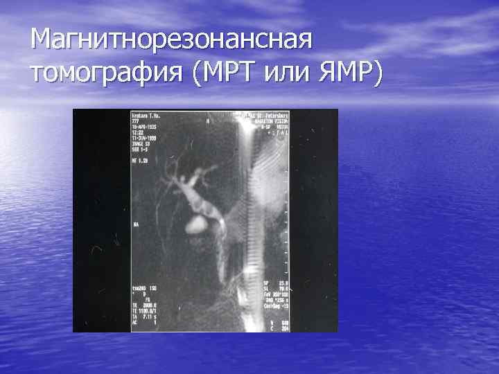 Магнитнорезонансная томография (МРТ или ЯМР) 