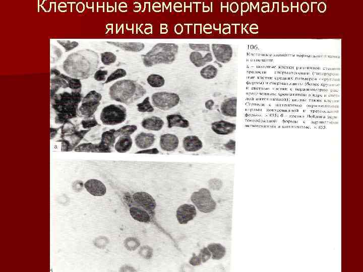 Клеточные элементы нормального яичка в отпечатке 