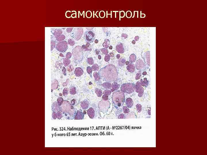 самоконтроль 