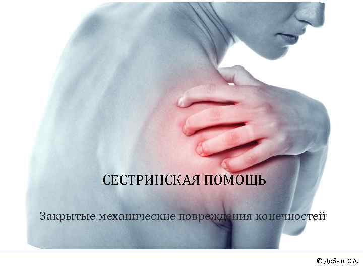 СЕСТРИНСКАЯ ПОМОЩЬ Закрытые механические повреждения конечностей © Добыш С. А. 