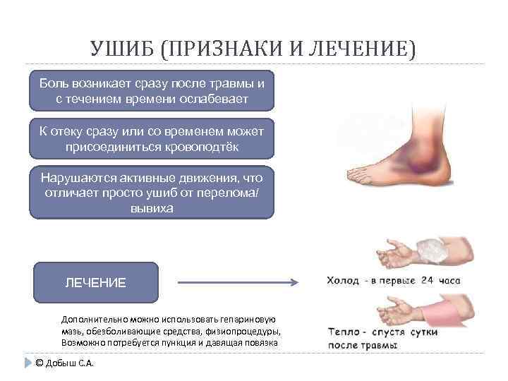 УШИБ (ПРИЗНАКИ И ЛЕЧЕНИЕ) Боль возникает сразу после травмы и с течением времени ослабевает