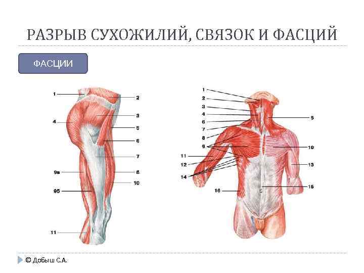 РАЗРЫВ СУХОЖИЛИЙ, СВЯЗОК И ФАСЦИЙ ФАСЦИИ © Добыш С. А. 