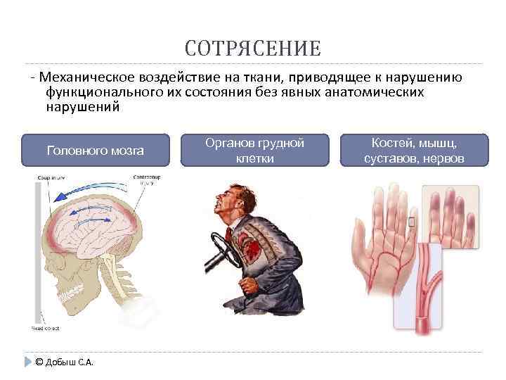 Механические повреждения автомобиля это