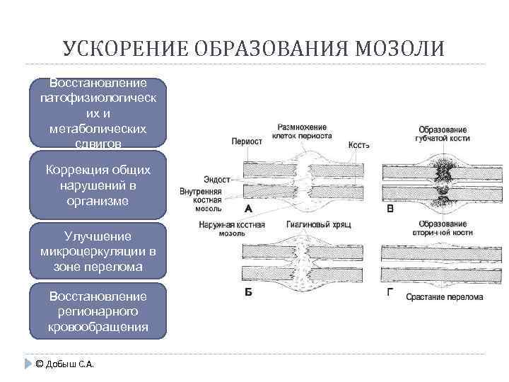 УСКОРЕНИЕ ОБРАЗОВАНИЯ МОЗОЛИ Восстановление патофизиологическ их и метаболических сдвигов Коррекция общих нарушений в организме