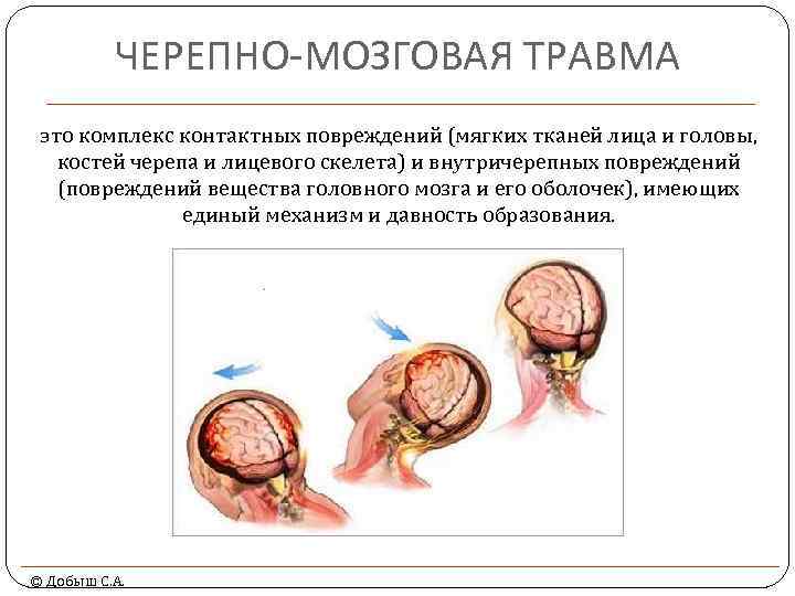 ЧЕРЕПНО-МОЗГОВАЯ ТРАВМА это комплекс контактных повреждений (мягких тканей лица и головы, костей черепа и