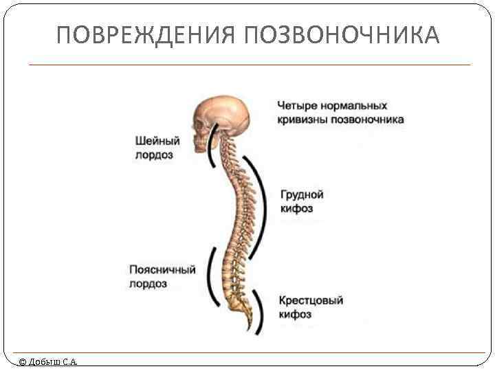 ПОВРЕЖДЕНИЯ ПОЗВОНОЧНИКА © Добыш С. А. 