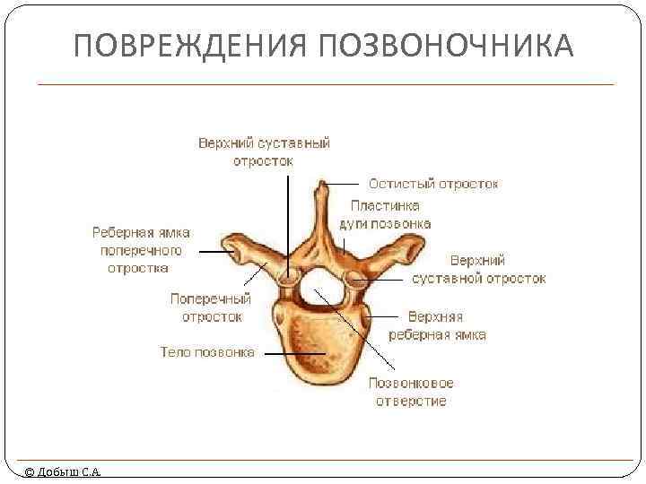 ПОВРЕЖДЕНИЯ ПОЗВОНОЧНИКА © Добыш С. А. 
