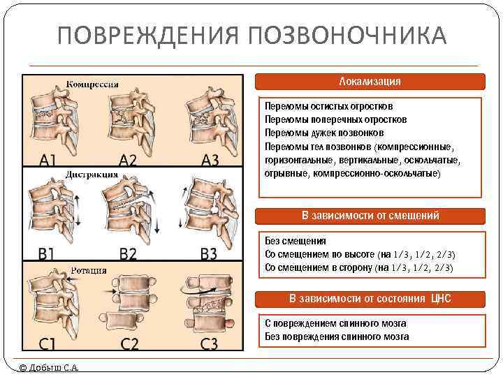 ПОВРЕЖДЕНИЯ ПОЗВОНОЧНИКА Локализация Переломы остистых отростков Переломы поперечных отростков Переломы дужек позвонков Переломы тел