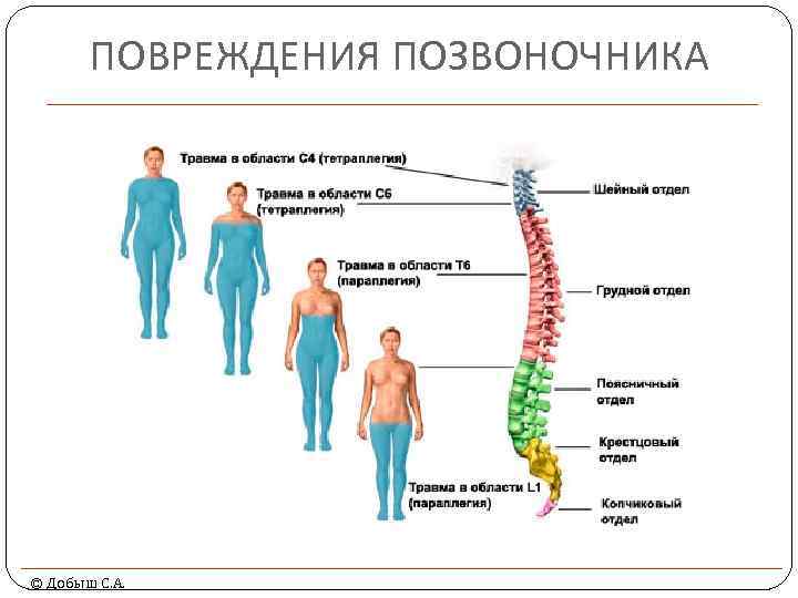 ПОВРЕЖДЕНИЯ ПОЗВОНОЧНИКА © Добыш С. А. 